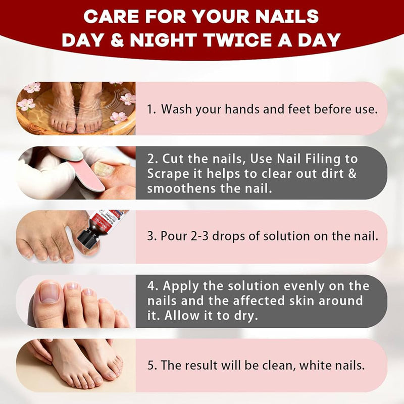Toenail Fungus Treatment - Fast Acting For Thick, Discolored, Broken & Damaged Toe & Finger Nail, Treats Damaged Nails and Ingrown Toenails - 30ml/1oz (2pcs) 2pcs
