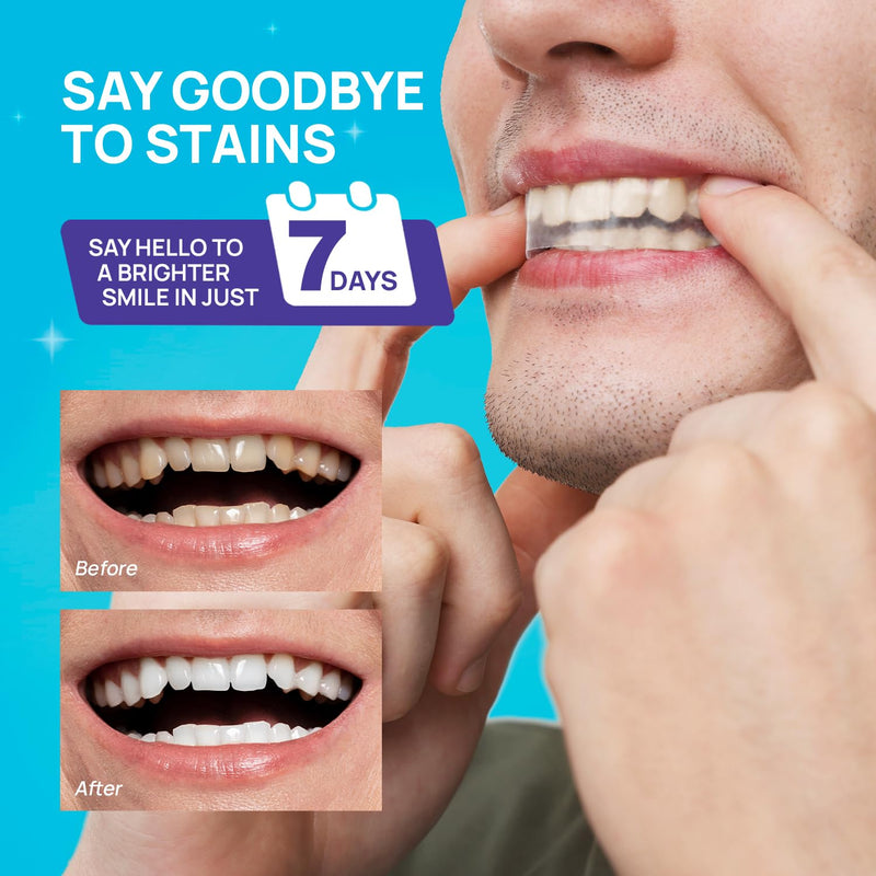 [Australia] - Teeth Whitening Strips 24 Treatments - Peroxide Free - Enamel-Safe Professional Dental Strips for Sensitive Teeth - Deep Stains Removal - Whitening without Any Harm - 48 Strips Mint 2 Count (Pack of 24) 