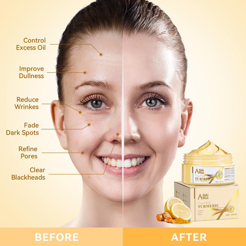 Turmeric Vitamin C Face Mask, 4.23 OZ | Deep Cleansing Clay Mask for Dull Skin, Skincare Facial Mask for Refining Pores & Controlling Oil, Smooth & Radiant Skin