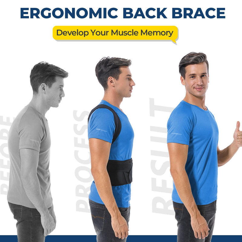 [Australia] - Posture Corrector for Women and Men, Brace for Upper and Lower Back Pain Relief, Adjustable and Fully Back Support Improve Back Posture and Lumbar Support(M, 30"-35.5" Waist) Medium (Pack of 1) 
