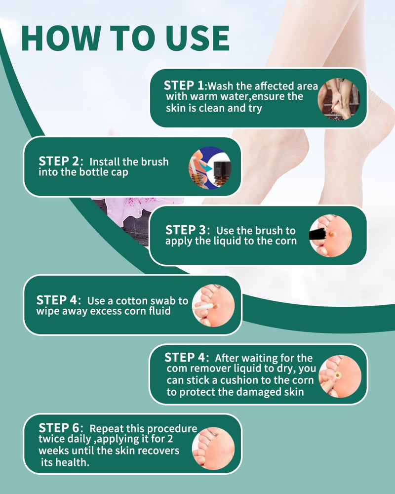 [Australia] - MQXUNMI 20 ml corn remover, corn remover, against corns and callus remover, corn remover, corn relief from corn pain and foot care 