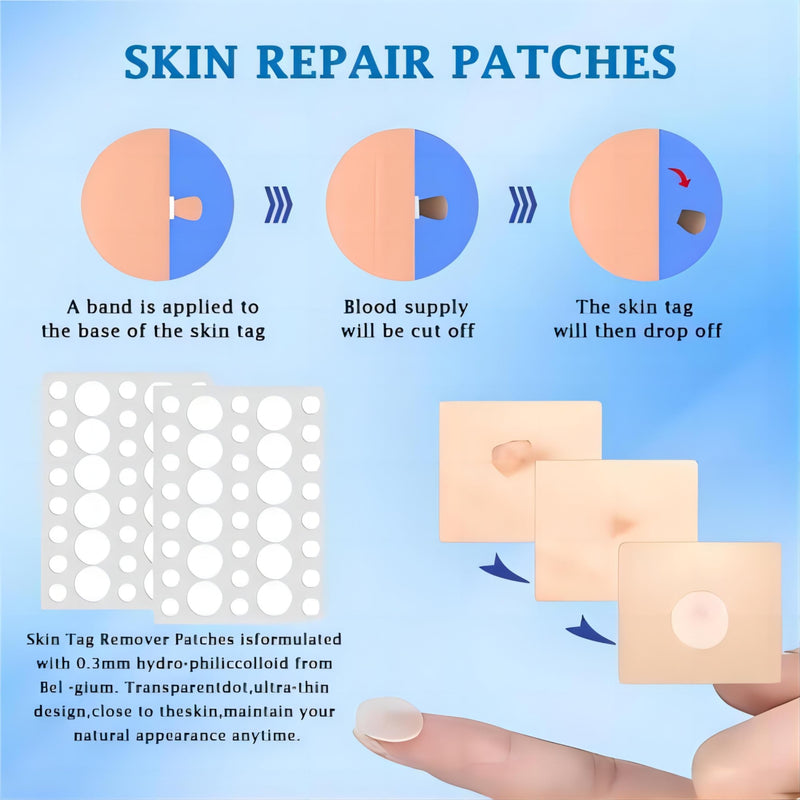 [Australia] - Micro Skin Tag Remover, Skin Tag Birthmark Remover, Auto Skin Tag Remover Kit, Stalk Wart Removal Quick Kit, Skin Tag Removal Pen, Wart Remover for Micro to Large (1-8 mm) 