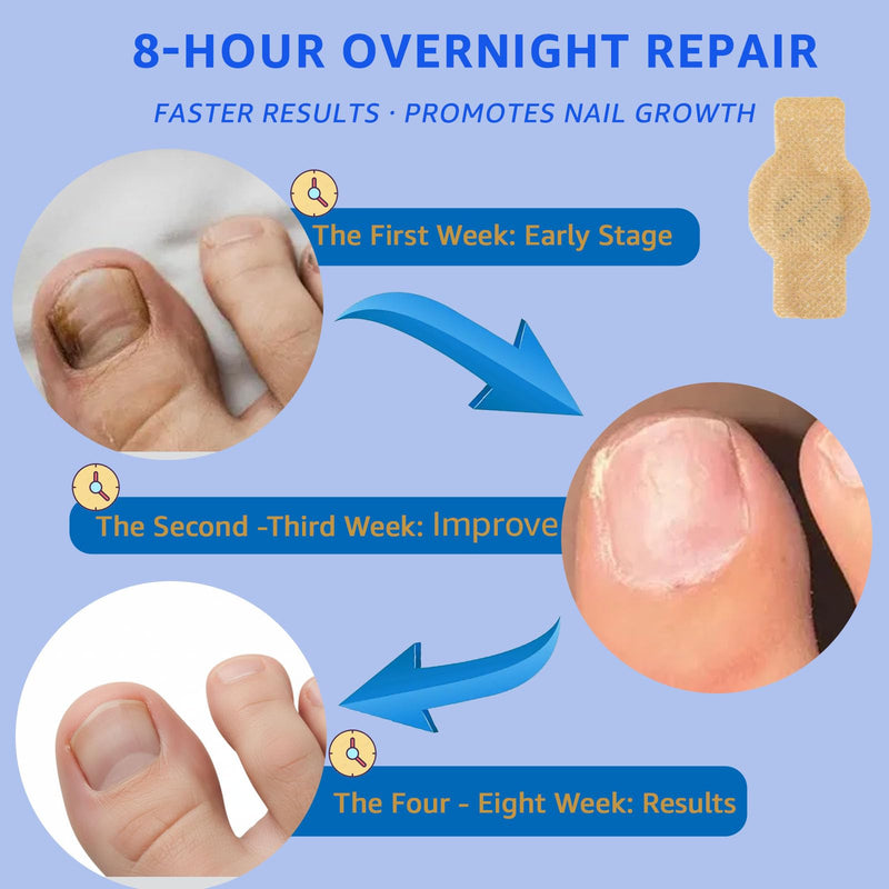 Nail Care Patches 21 PCS, 8-Hour Overnight Toenail Repair and Care Extra Strength, Fast Improvement for Women & Men's Damaged Nails Helps Restore Appearance for Travel Sports 1 Count (Pack of 1)