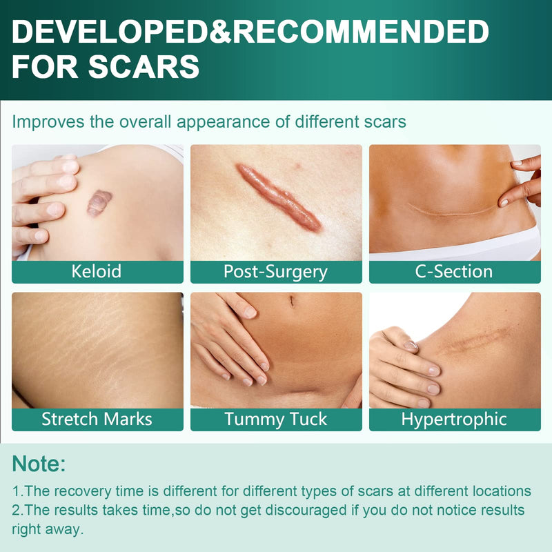 [Australia] - Silicone Scar Sheets,Silicone Scar Tape(1.6"x 120" Roll-3M), Reusable and Effective Scar Removal Sheets, Silicone Scar Removal Sheets for Surgical Scars,Healing Keloid, C-Section, Tummy Tuck 1.6"x 120" Roll 
