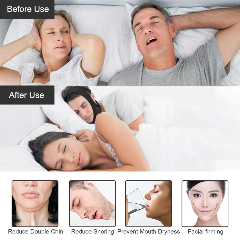 [Australia] - Chin Strap - Chin Strap for Cpap Users, Cpap Chin Strap, Anti Snoring Chin Strap Black 