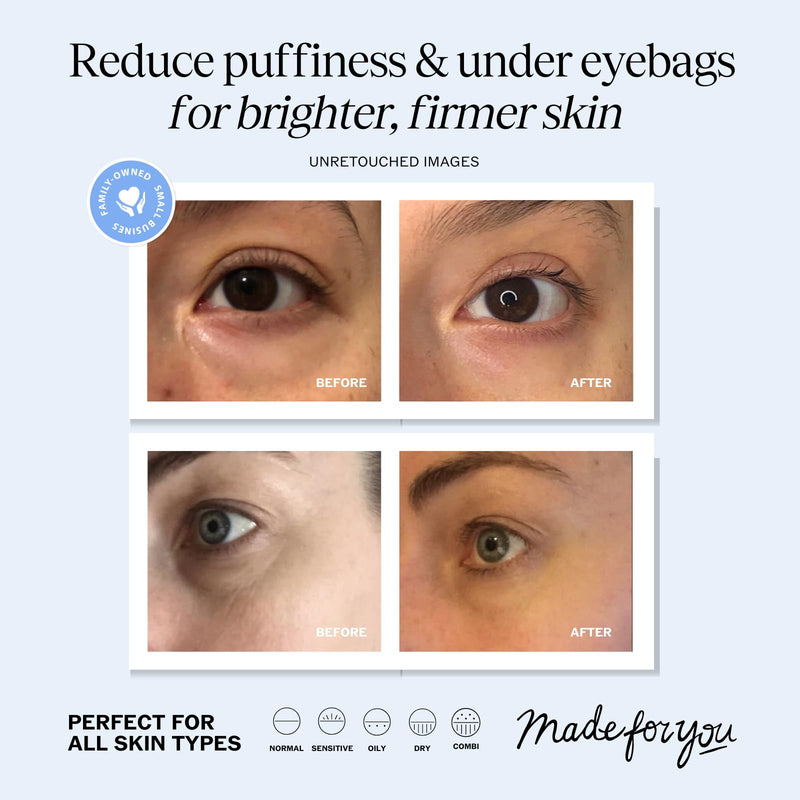 [Australia] - LilyAna Naturals Eye Cream for Dark Circles and Puffiness, Under Eye Cream for Wrinkles and Bags, Anti Aging Eye Cream helps Improve Dryness; for Sensitive Skin - 1.7 oz - Made in USA Bottle 1.7 Ounce (Pack of 1) 
