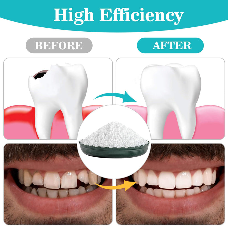 [Australia] - Sukh 10.9oz Repair Thermoplastic Beads Moldable Plastic Pellets Polymorph Plastic Meltable Plastic Reusable Thermal Beads for Missing Tooth,DIY,Cosplay,Halloween Vampire Teeth Fangs 