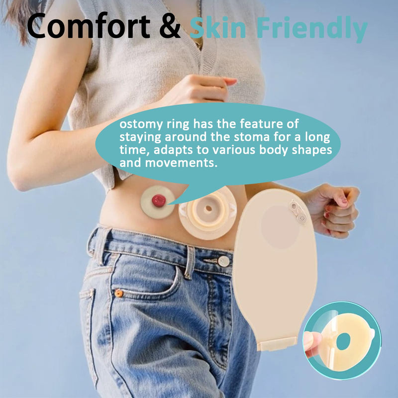 [Australia] - 20PCS Ostomy Barrier Rings, Medical Hydrocolloid Ostomy Supplies, Moldable Ostomy Ring, Leak-Free Skin Extender Rings, Stoma Protector Seal for Colostomy Bags 
