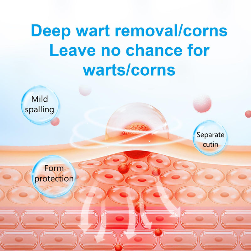 [Australia] - 2 Packs Fast-Acting Salicylic Remover: Strongest Wart Corn Removers for Feet, Body and Neck.Exclusive Formula 17% Salicylic for Plantar„ÄÅFlat„ÄÅCommon Wart, Corn. for Men and Women - 2 * 30ML 