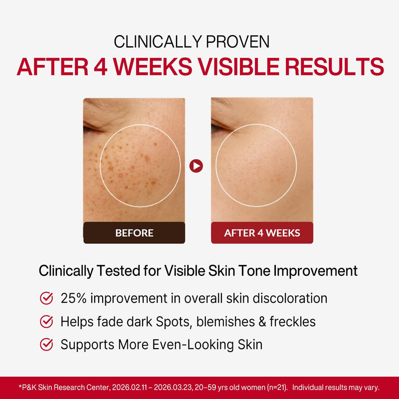 Camellia TXA CHIMTOK™ Serum, Tranexamic Acid Serum for Dark Spots, Hyperpigmentation & Melasma, TXA + Vitamin C, Korean Brightening Serum with Micro-Spicule Texture Care, 1.01 fl oz Camellia TXA Dark Spot Serum