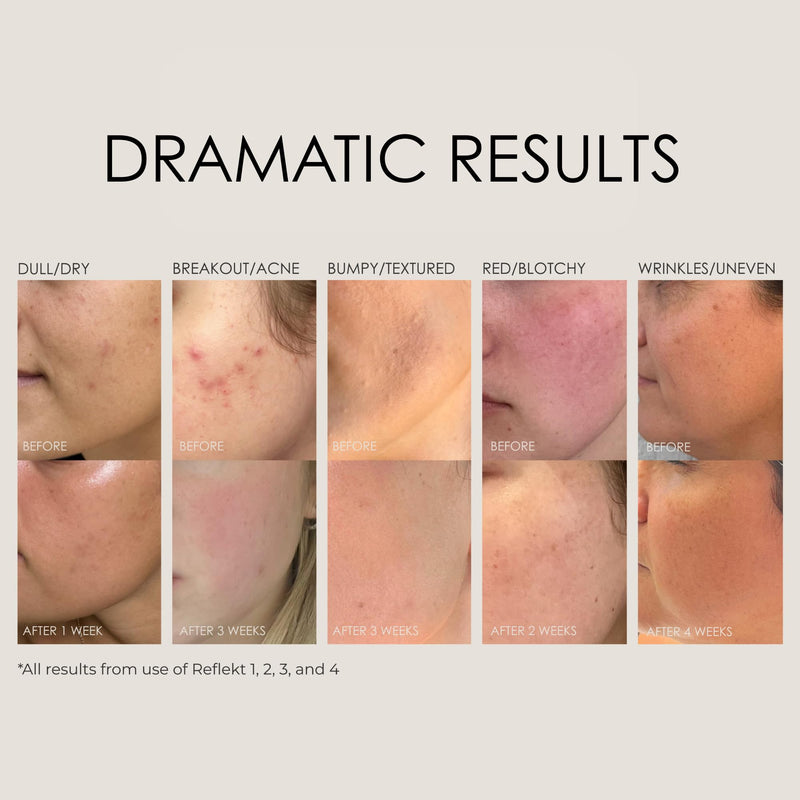 Reflekt 2 Collagen Boost Vitamin C Brightening Serum REFLEKT 2