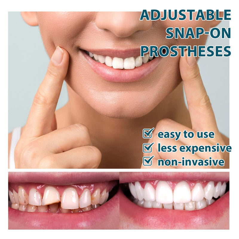 [Australia] - Prostheses Fake Teeth, Smile Teeth Veneers, Cosmetic Temporary Teeth Dentures Prosthesis Artificial Veneers Teeth Top and Bottom Teeth 02 