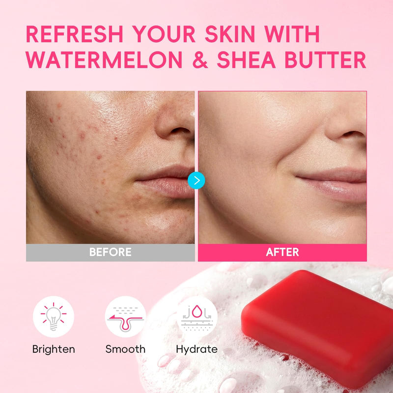 QUIYUM Watermelon Shea Butter Handmade Soap, 3-in-1 Face & Body Bar Soap | Niacinamide, Vitamin E & Jojoba Oil, Hydrating and Glowing Daily Cleanser for All Skin Types, Refreshing Fruity Scent