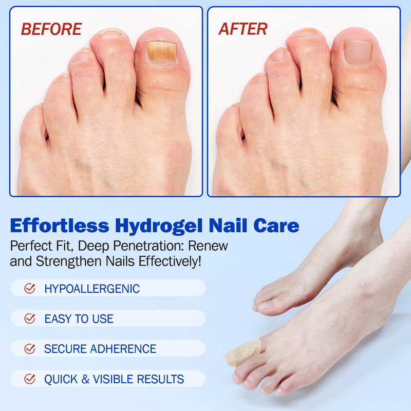 Nail Patches 21Pcs, Toenail & Fingernail Care Patches, 8-Hour Overnight Hydrogel Adhesive Wrap for Dry Brittle or Cracked Nails 1 Count (Pack of 21)