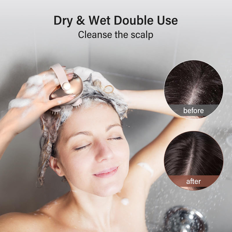 arboleaf Scalp Massager Kneading Head Massager Scalp Stress Relax Portable Rechargeable Hair Massager Shower Massage Waterproof Cat Massager Scratcher,Gift for Mom Dad | 128 massage nodes, 8 removable claws, cat scratcher, gift for Mom Dad Rose Pink