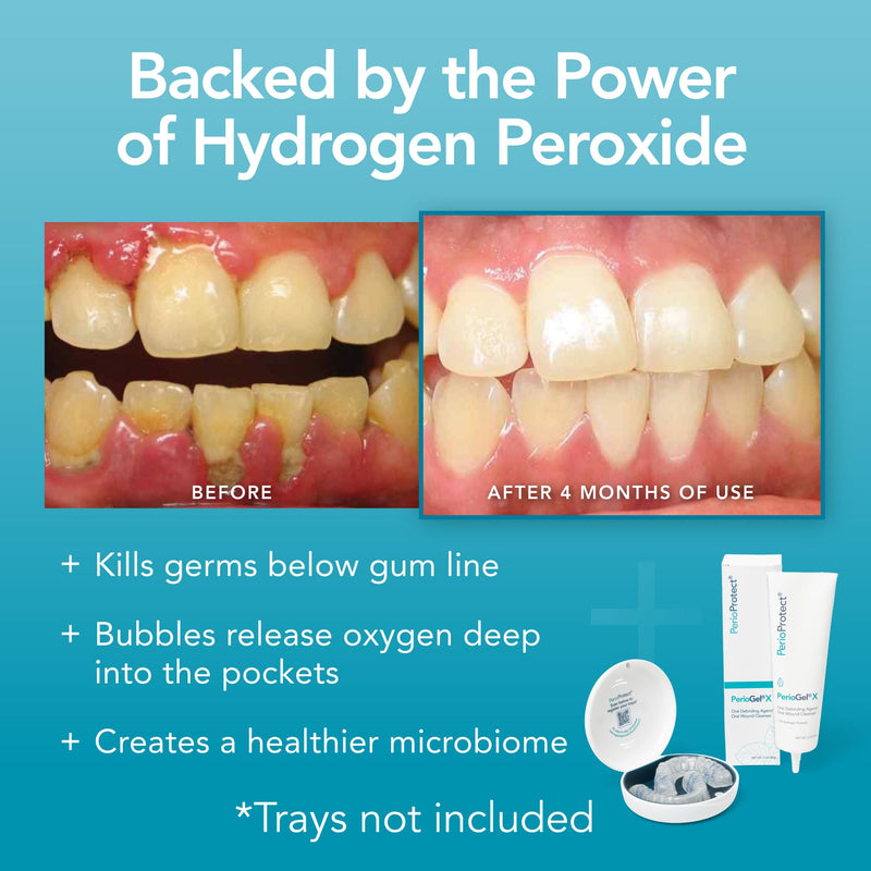 PerioGelX | Periodontal Treatment for Teeth | Promotes Teeth Whitening (3 oz.) Mint