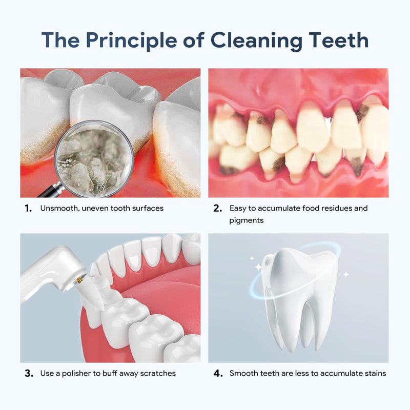 6 Tooth Polisher Replacement Brush Heads,Tooth Cleaning Replacement Set for Daily Tooth Cleaning,Whitening and Polishing for Electric Tooth Polishers