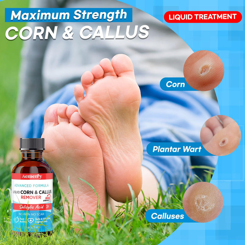 [Australia] - Corn Removers for Toes Foot: Liquid Salicylic Acid 17% Corns Calluses Removal Extra Strength, Fast Acting Corn Remover for Feet Fingers. 30ml 