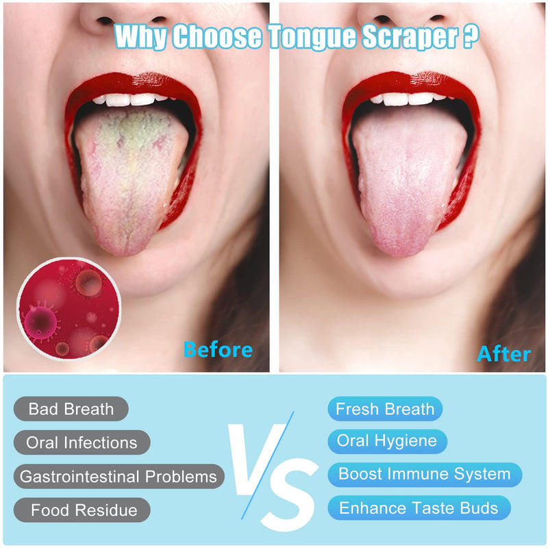 [Australia] - MORGLES Copper Tongue Scraper, 4Pcs Tongue Scraper with Case Medical Grade Tongue Scrapers for Adults Kids, Great for Oral Hygiene Bad Breath, Gold 