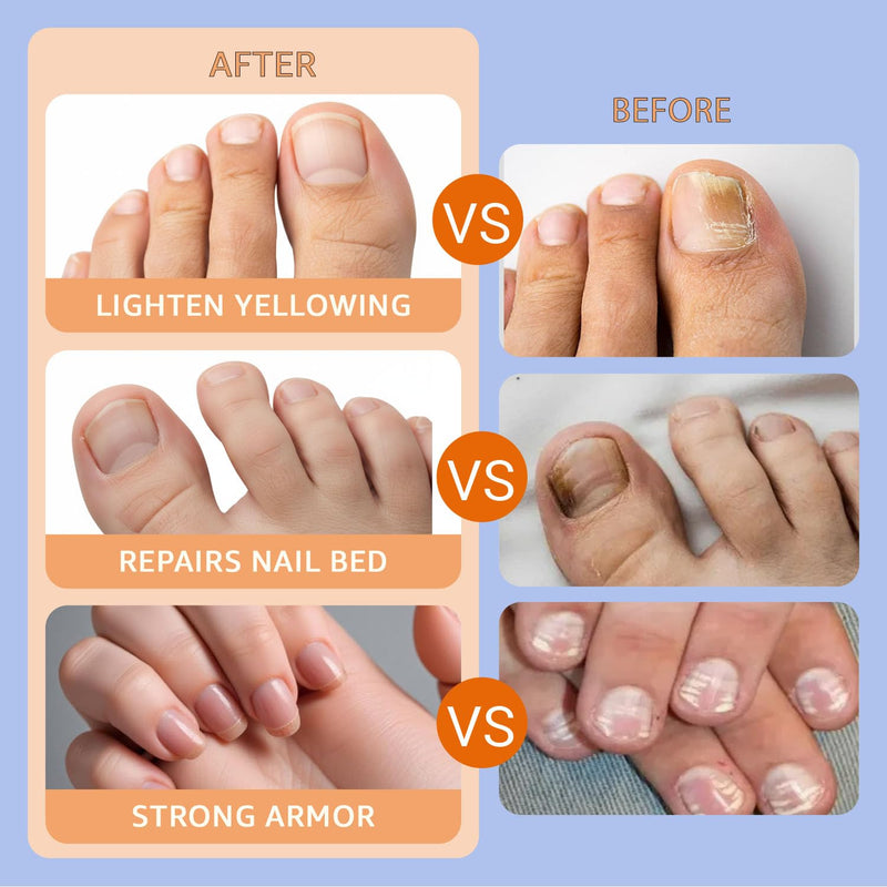 Nail Care Patches 21 PCS, 8-Hour Overnight Toenail Repair and Care Extra Strength, Fast Improvement for Women & Men's Damaged Nails Helps Restore Appearance for Travel Sports 1 Count (Pack of 1)