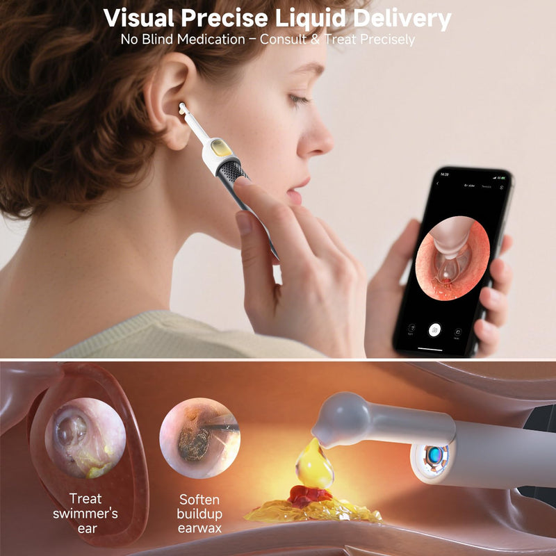 [Australia] - BEBIRD R1 Ultra Ear Wax Removal, Ear Cleaner with Camera Ear Scope, Wax Remove Ear Pick with Ear Otoscope Tweezers, Visual Dropper Cleaning Kit, Ear/Nose/Throat Examination Tool for Family 