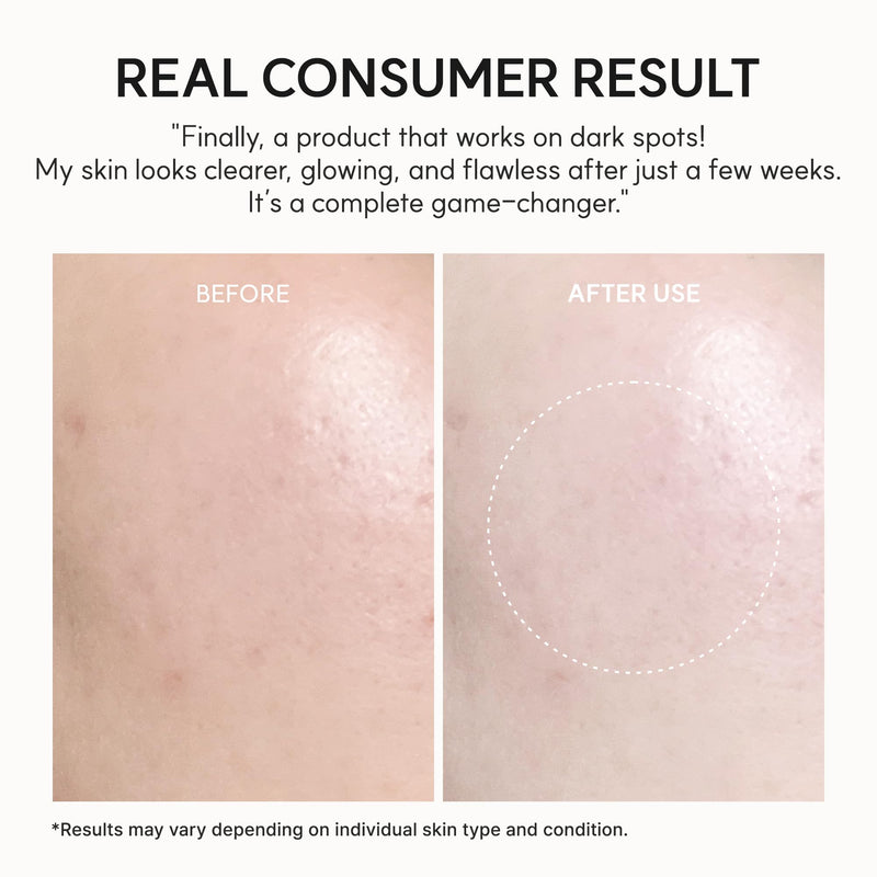 Arencai Vitamin C Booster Gel Cream with Niacinamide & Glutathione & Ceramide, Hydrating Gel Moisturizer, Supports Even-Looking Skin Tone & Smooth Texture, 50 g (1.76 oz)