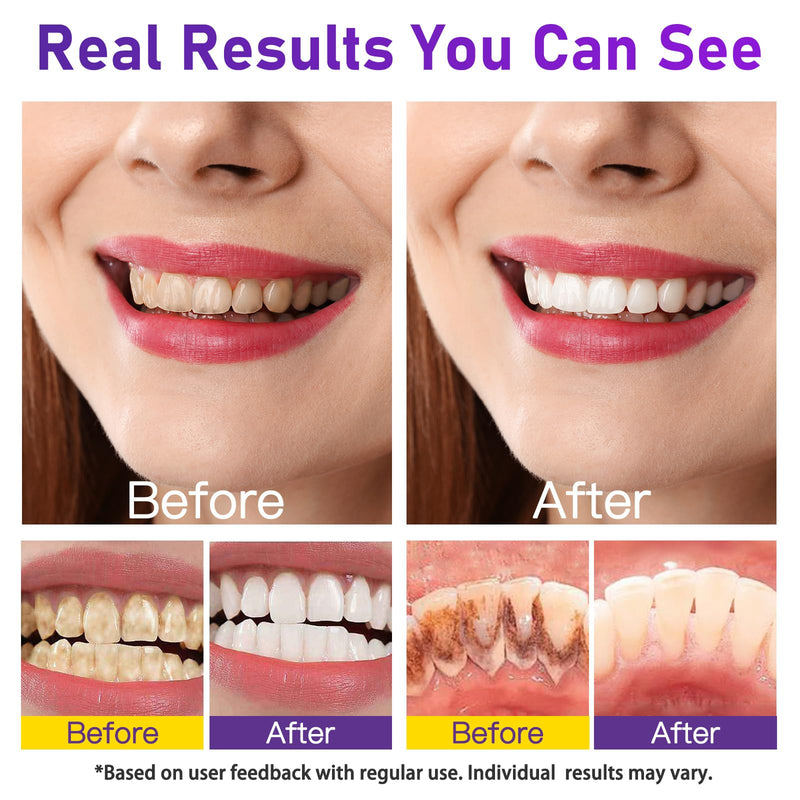 Teeth Whitening Powder - Teeth Whitening - Removes Stains - No Sensitivity - Toothpaste Power - Breath Freshener - for Coffee, Tea and Tobacco Stains 15g
