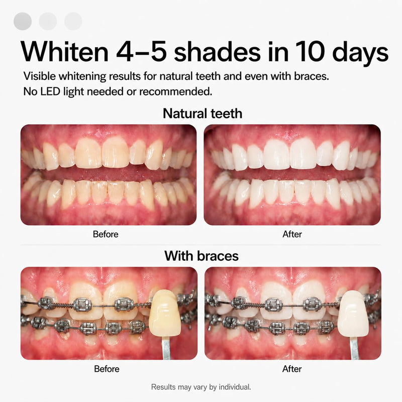 Opalescence Go Teeth Whitening Trays 15% Hydrogen Peroxide - Mint - 4648-1 | Fast Results (1 Packs / 4 Treatments) Dentist Developed - Low Sensitivity - Gentle on Enamel - by Ultradent Products USA Original 1 Count (Pack of 4)