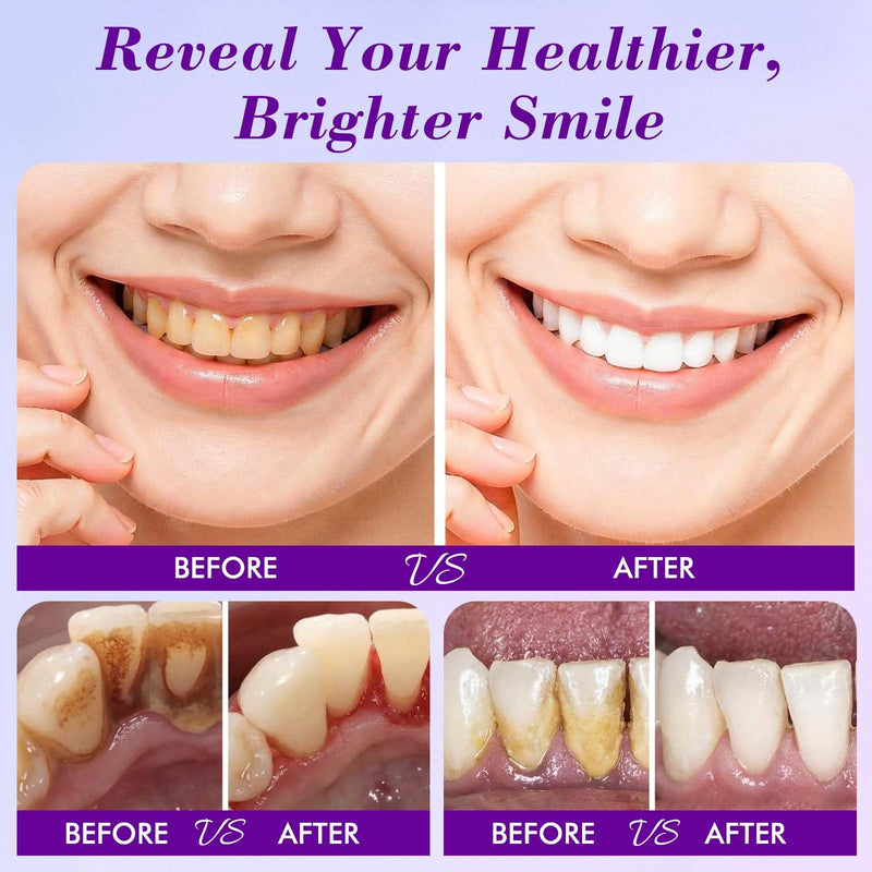 2 PCS Teeth Whitening Powder, Nano Hydroxyapatite Remineralizing Tooth Powder with Niacinamide,R5X Advanced Purple Color Balance Immediate Results, Mint Flavor, 2 * 50 Grams