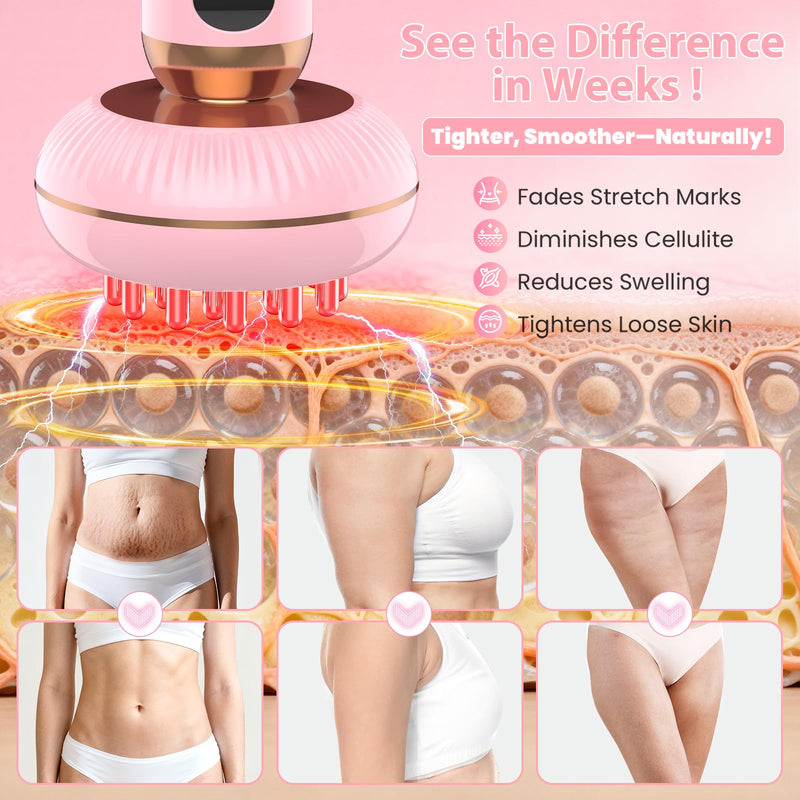 Handheld Body Massager for Lymphatic Drainage Lymphedema Lipedema | 4-in-1 Red Light Heat Vibration, Reduce Cellulite Stretch Marks, Relieve Sciatica Pain Device Pink