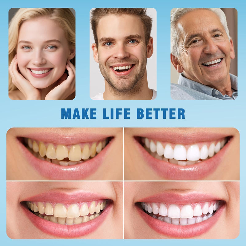 [Australia] - Moldable False Teeth - Silicone Dentures - Men and Veneers Teeth for Women - Upper and Lower Matching Set - Fix Your Smile at Within Minutes - Blue - 1PCS 