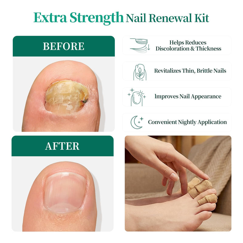 APUREE Fungal Nail Patches Extra Strength: 1% Tolnaftate Nail Repair 64PCS | FSA-HSA Eligible With NDC 84167-332-23, Trim To Fit, Breathable, Restores Discolored Yellow Thick Nails, With Precision File