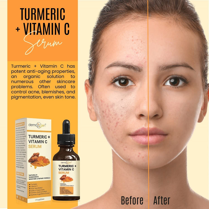 Turmeric and Vitamin C Anti-Aging facial serum, PURE ORGANIC Reduce Wrinkles, Improve Blemishes and Acne, Skin firming and Intensive Moisturizing & hydrating Serum for all skin Types (1 fl oz)) 1 Fl Oz (Pack of 1)