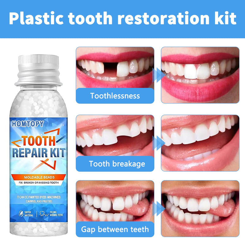 [Australia] - Tooth repair set, tooth repair set, make your own dentures, tooth glue for teeth, temporary tooth cement, artificial tooth filling for clipping on, dentures, dental care, temporary tooth repair 