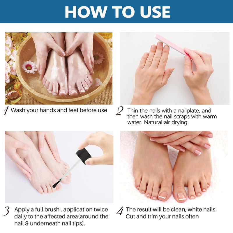 [Australia] - Toenail Fungus Treatment Extra Strength, Toe Fungus Treatment for Toenail, Toe Nail fungus Treatment Extra Strength, Nail Treatment, Safely and Gently 1 Fl Oz (Pack of 1) 1 Fl Oz (Pack of 1) 