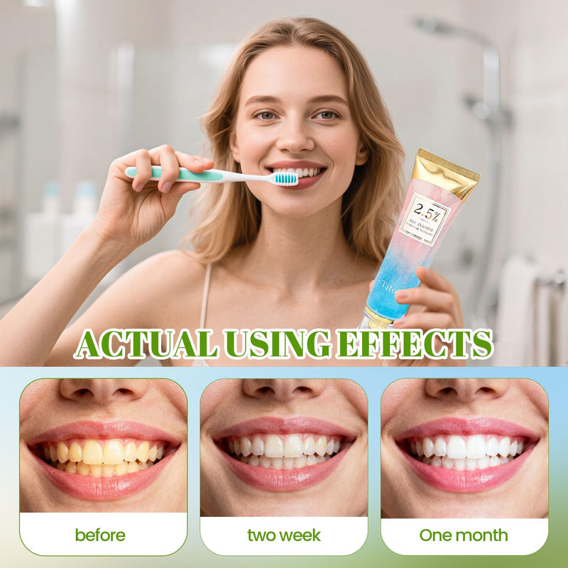 2pcs Niacinamide Whitening Toothpaste, 2.5% Niacinamide Intensive Whitening Toothpaste with Natural Gentle Care Deep Stain Removal Clean Mint Flavor, Improves Gum Health, Fresh Breath (2)