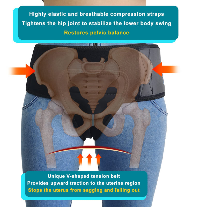 Pelvic Support Belt Uterus Support Belt Women's Brace for Treating Dropped Bladder, Uterine Prolapse, Vulvar Varicosities, Postpartum and Symphysis Pubis Dysfunction Medium