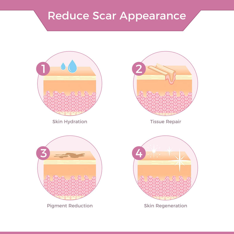 [Australia] - Silicone Scar Tape Scar Sheets - Professional Medical Grade Scar Removal Treatment, Non irritating, Painless for C-Section, Surgical Scars, Burn, Keloid, Acne(1.6” x 60” Roll) 4x150cm 