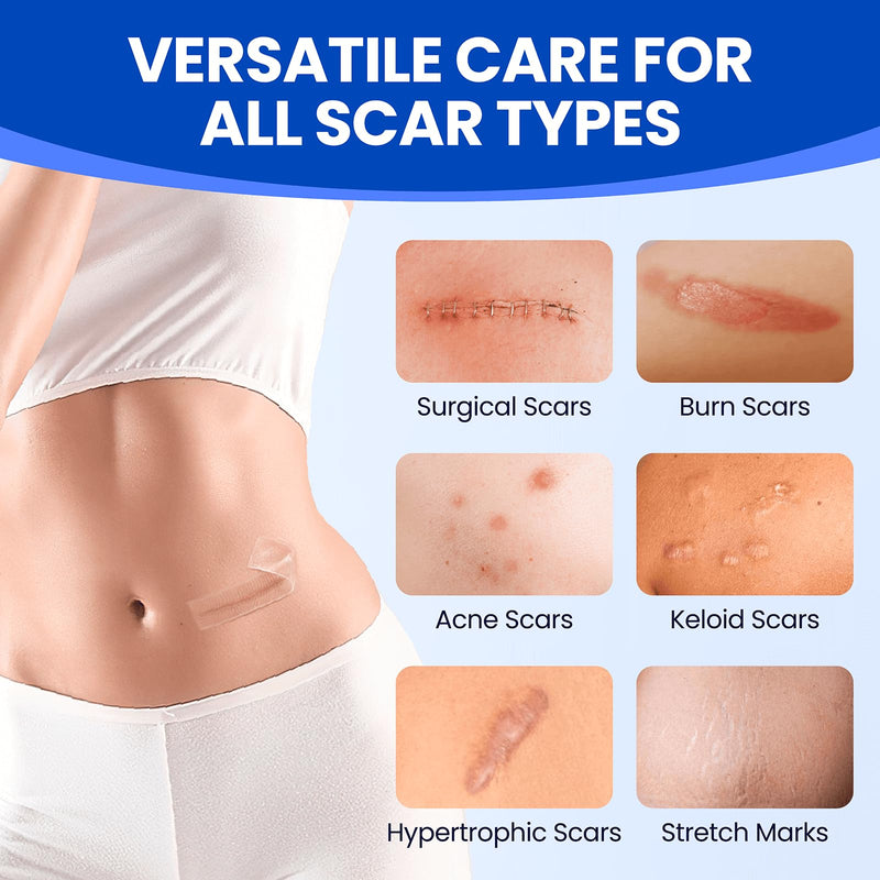 [Australia] - Silicone Scar Sheets Medical Grade Tape (1.6"x60" Roll), Healing Patches for C-Section, Keloid, Face Wrinkles, Stretch Marks, Surgical Recovery, Professional Scar Cover for Sensitive Skin, Soft Tissue 1.6"X60‚Äú 