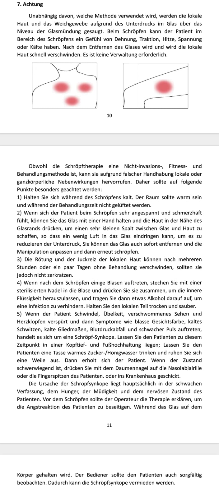 [Australia] - ELERA Silicone Cupping Therapy Set, Professionally Chinese Massage Cups for Cupping Therapy and Cellulite Reduction (7 Cups) 3 size 7 pieces 