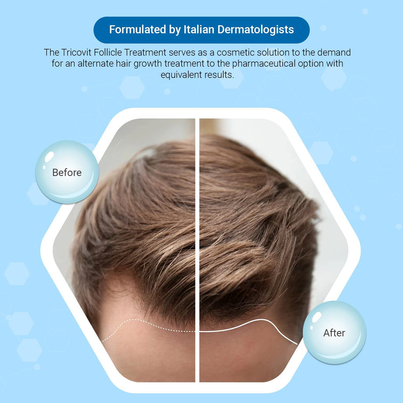 Tricovit Hair Growth Supplement - Nail & Hair Health Vitamins with Amino Acids, Minerals & Antioxidants - Dermatologist-Formulated & Gluten-Free Vitamins and Supplements for Women & Men (60 Tablets)