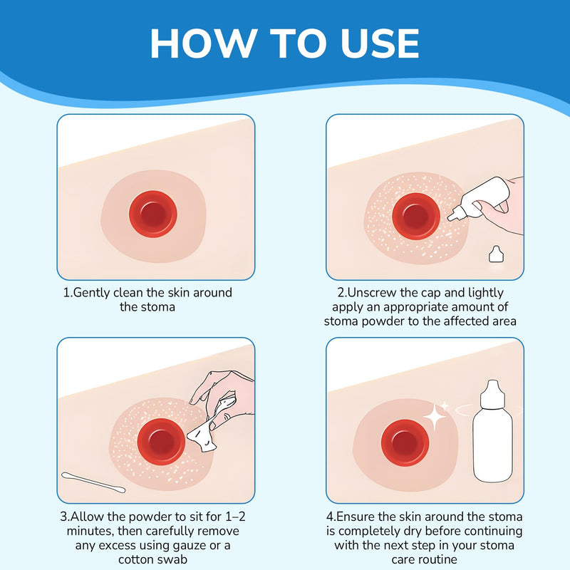 [Australia] - Heagied Stoma Powder, Skin Barrier Protection Ostomy Powder Supplies, Stoma Adhesive Powder, Ostomy Skin Care Powder, Ostomy Supplies(25g) 