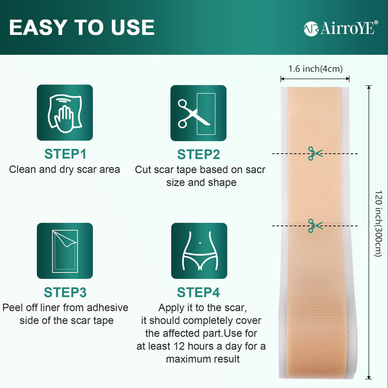[Australia] - Silicone Scar Sheets,Silicone Scar Tape(1.6"x 120" Roll-3M), Reusable and Effective Scar Removal Sheets, Silicone Scar Removal Sheets for Surgical Scars,Healing Keloid, C-Section, Tummy Tuck 1.6"x 120" Roll 