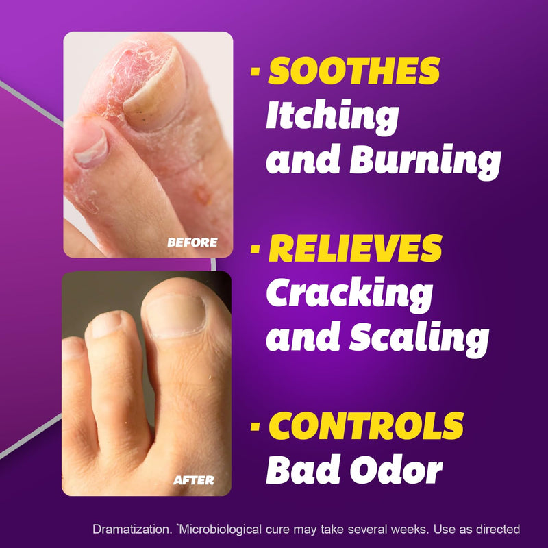 Silka Antifungal Cream, Terbinafine Hydrochloride, 1 oz, 2 Pk | Results in 1 Week, Athlete’s Foot Treatment,Clinical Anti-Fungus Foot Treatment, Jock Itch & Ringworm Treatment for Humans