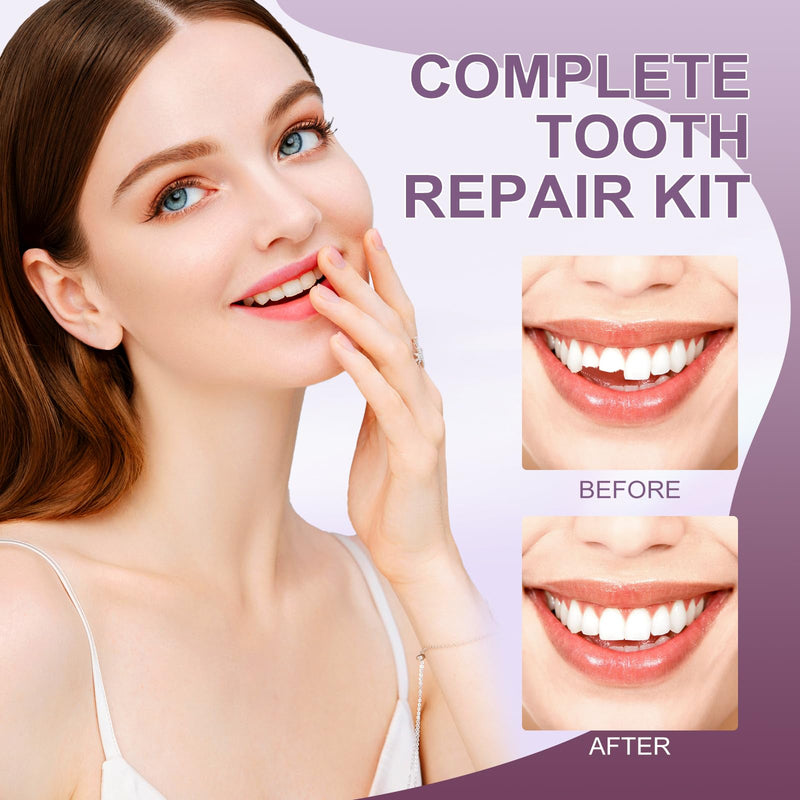 [Australia] - Tooth Repair kitÔºåTeeth Repair Kit for Filling The Missing Broken Tooth and Gaps-Moldable Fake Teeth and Thermal Beads Temporary Replacement Kit-L002 