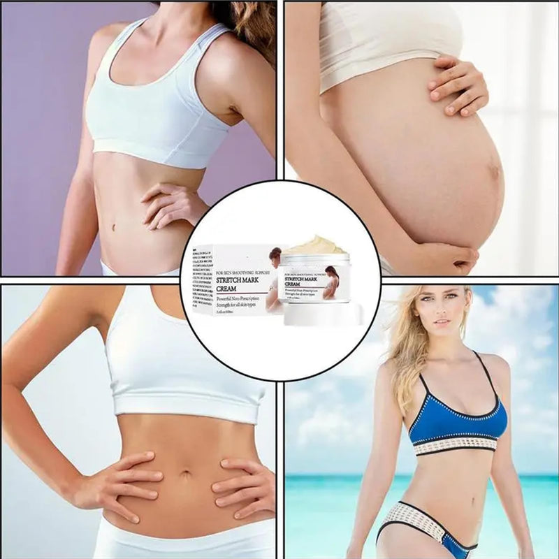 Stretch Mark Prevention Cream for Pregnancy, Stretch Mark Cream Remover, Stretch Mark Lotion for Pregnancy, Tummy Butter for Stretch Marks Pregnancy, Shea Butter Stretch Mark Removal Cream