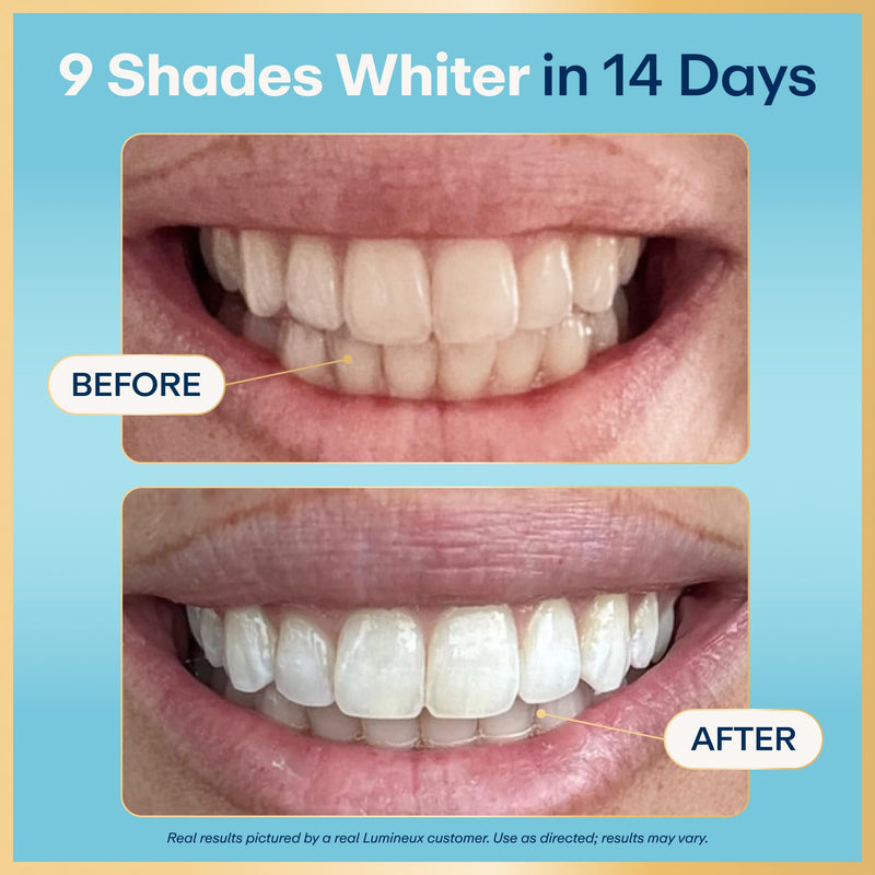Lumineux Teeth Whitening Strips, Peroxide Free, 21 Treatments (3 Months) | Peroxide free, enamel safe, dentist formulated, clinically tested & proven, free from harsh ingredients, no sensitivity 3 Month Supply