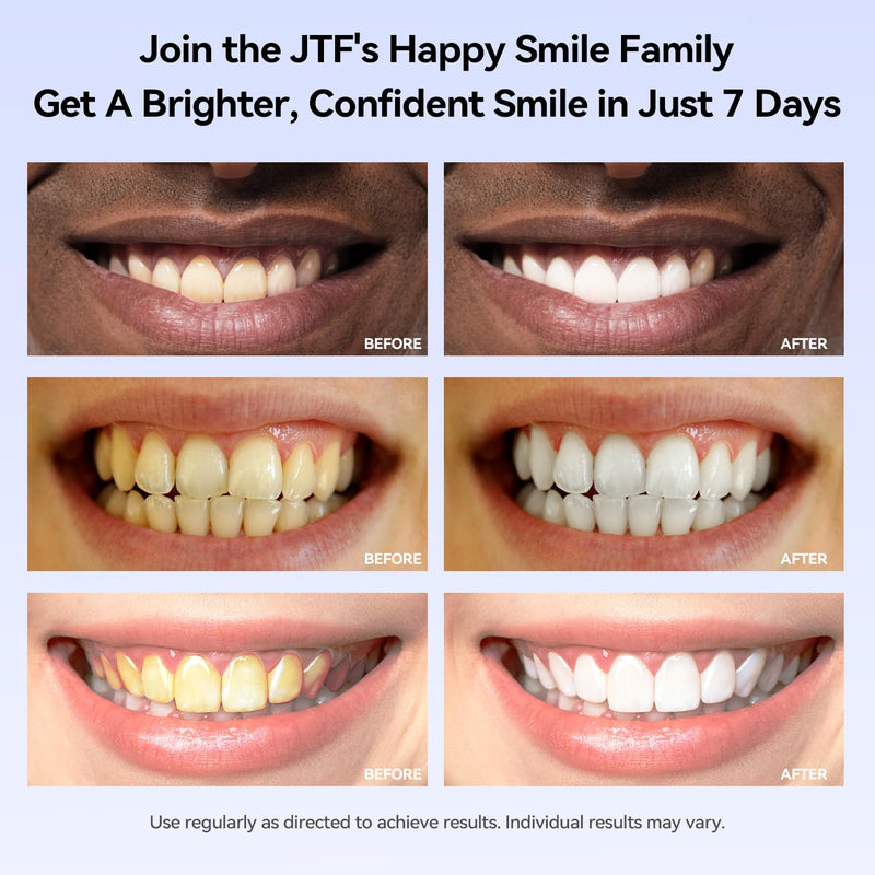 [Australia] - JTF Portable Teeth Whitening Kit: LED Accelerator Light with 5 Whitening Gel and 1 Remineralization Gel, 35% Carbamide Peroxide, Battery Powered Teeth Whitener to Remove Stain for Brighter White Smile 