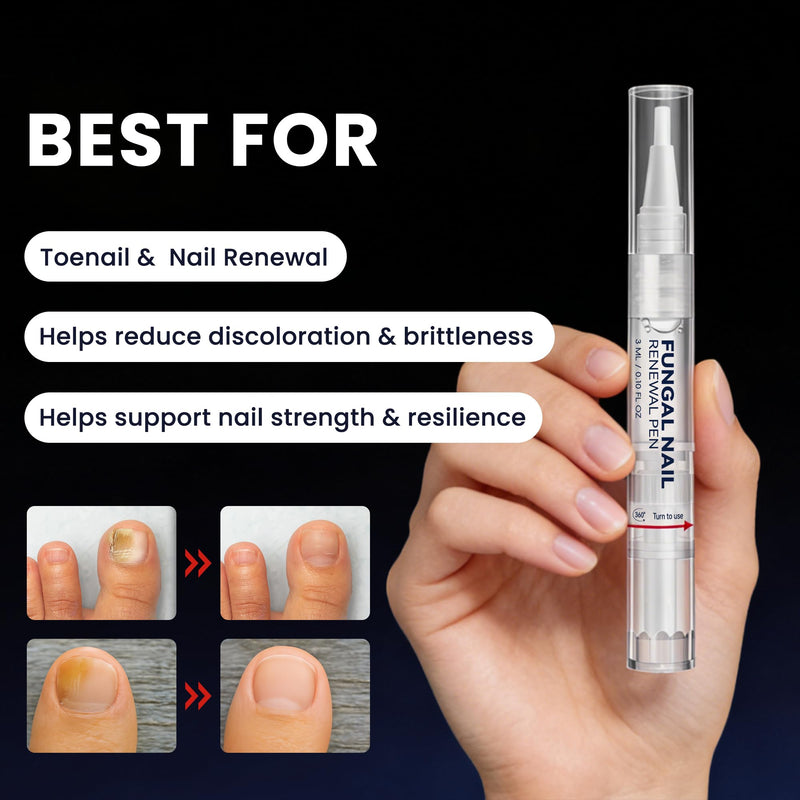Toenail Fungus Pen: 25% Undecylenic Acid & 1% Tolnaftate for Clear Nails | EXTRA STRENGTH / DUAL-POWER / COMPLETE KIT 0.1 Fl Oz (Pack of 6)