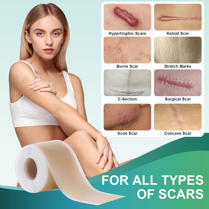 Medical Grade Silicone Scar Sheets, Silicone Scar Tape (1.6”x 60” Roll-1.5M), Professional Scar Removal Treatment, Reusable Silicone Scar Strip for Keloid, C-Section, Surgery, Burns, Acne Etc Brown